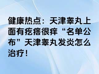健康热点：天津睾丸上面有疙瘩很痒“名单公布”天津睾丸发炎怎么治疗！